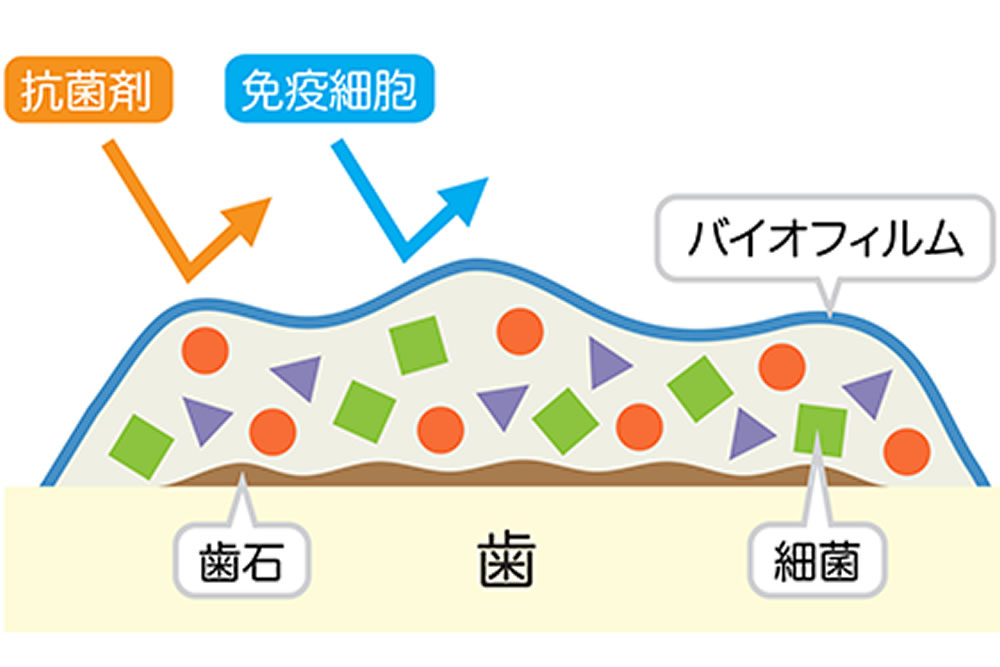 矢口渡・池上・蓮沼・武蔵新田・蒲田の歯医者、のびのび歯科・矯正歯科の予防歯科