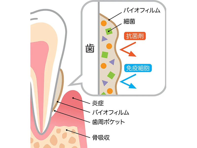 矢口渡・池上・蓮沼・武蔵新田・蒲田の歯医者、のびのび歯科・矯正歯科の予防歯科